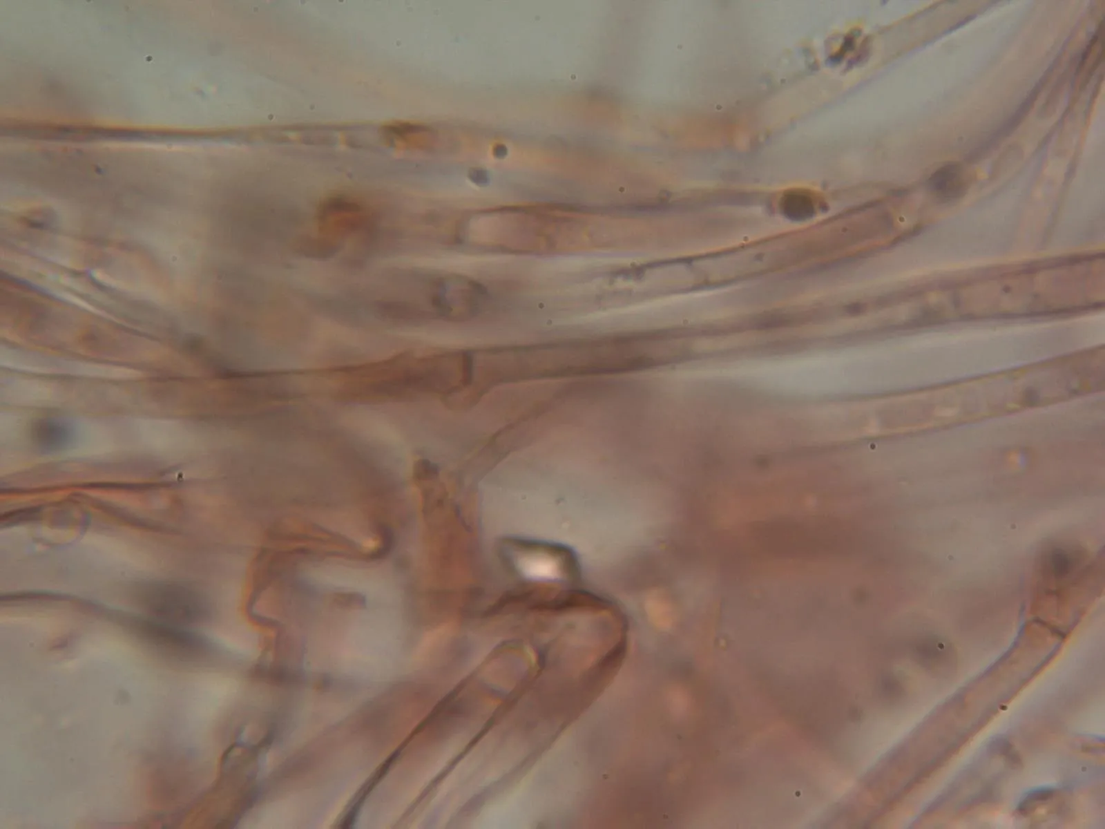 Microscopía de Rhodocollybia butyracea - 11 - Suprapellis